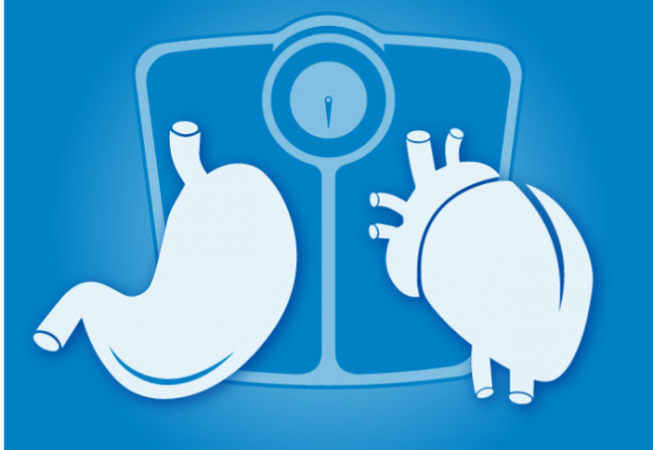 Cirugía Bariátrica para la obesidad a los 65 años y más: una victoria  cardiovascular
